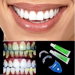 Система за избелване на зъби WhiteLight