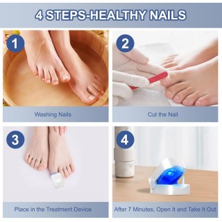 Лазерен уред за терапия на гъбички по ноктите